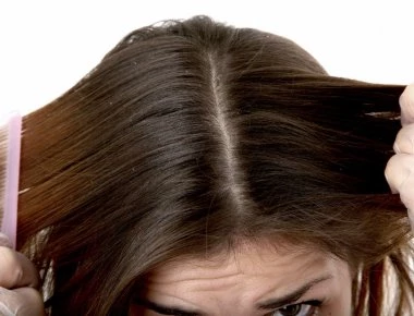 Άσπρες νιφάδες στα μαλλιά: Πότε είναι πιτυρίδα και πότε ξηροδερμία